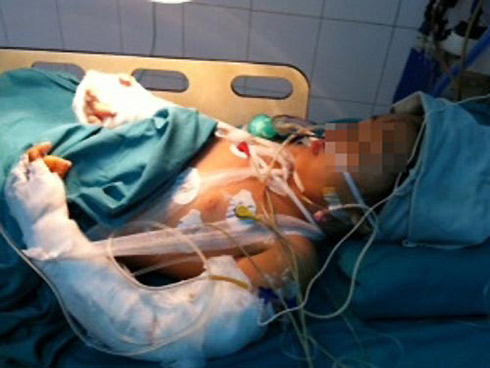 Bé Trịnh Thị Ngọc Bích, 8 tuổi, vẫn đang được theo dõi tại Bệnh viện Việt - Đức. Ảnh: NLD