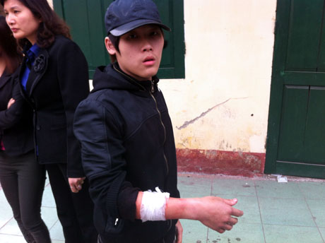 Học sinh Đào Mạnh Cường thương ở tay sau khi bị côn đồ chém.