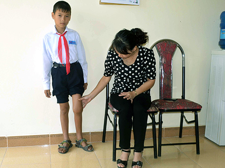 Hàng ngày cháu Vũ Văn Hùng đến trường với đôi chân sưng to 7 năm nay.