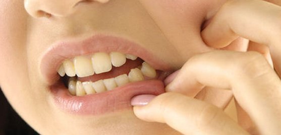 Nhiều bệnh nhân rất ngạc nhiên khi biết rằng trên 60% người lớn bị sâu răng. Ảnh minh họa