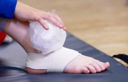 Người bệnh cần băng ép cố định và chườm lạnh khi bị bong gân.