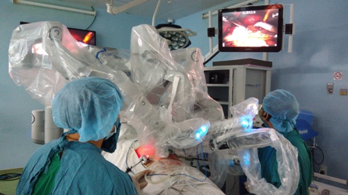 Ca phẫu thuật ứng dụng robot điều trị cho bệnh nhân bị nang ống mật chủ đã thực hiện thành công. Ảnh: CTV