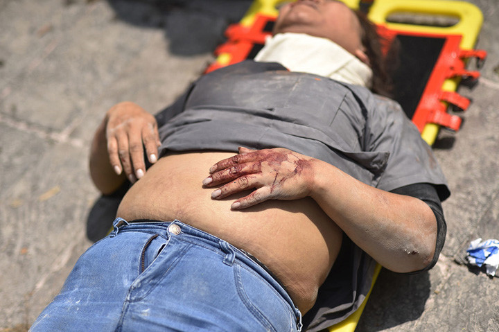 Người bị thương trong cuộc động đất ở Mexico City vào ngày 19/9. Ảnh: Getty.