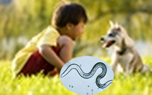 Trẻ em là đối tượng dễ bị nhiễm sán chó nhất. Ảnh minh họa: Wikihow.