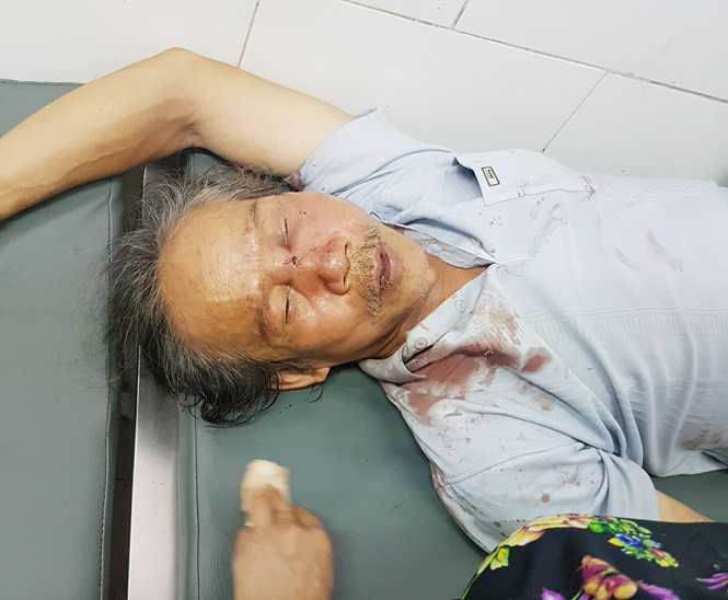 Ông Phan Văn Quang bị bảo vệ chung cư Sài Gòn Metro Park đánh, phải nhập việnẢNH: Phan Huy Đỉnh