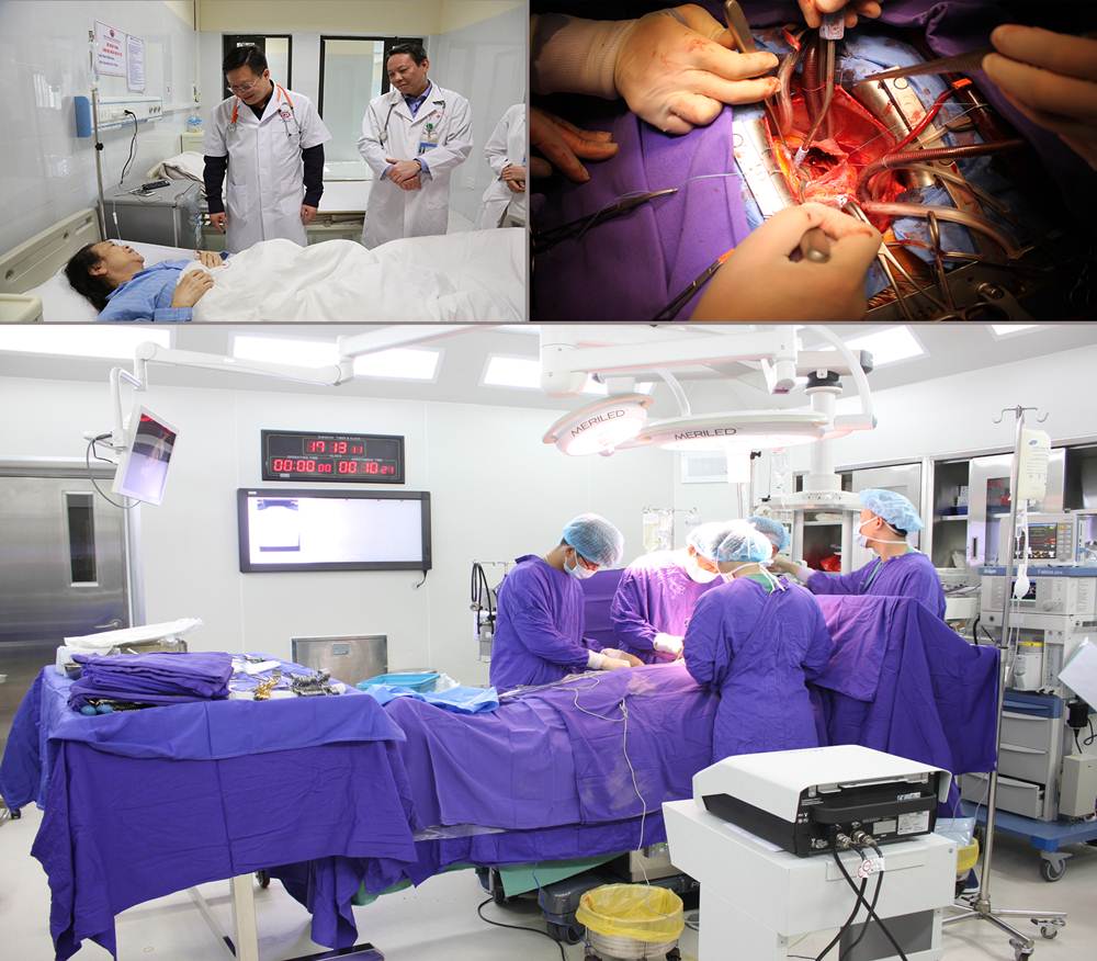 Nhiểu bệnh viện của tỉnh đã làm chủ các kỹ thuật can thiệp tim mạch. Trong ảnh: Bệnh viện Đa khoa tỉnh đã tăng cường đầu tư để phát triển các kỹ thuật trong lĩnh vực tim mạch, đặc biệt bệnh viện đã làm chủ kỹ thuật phẫu thuật tim hở.