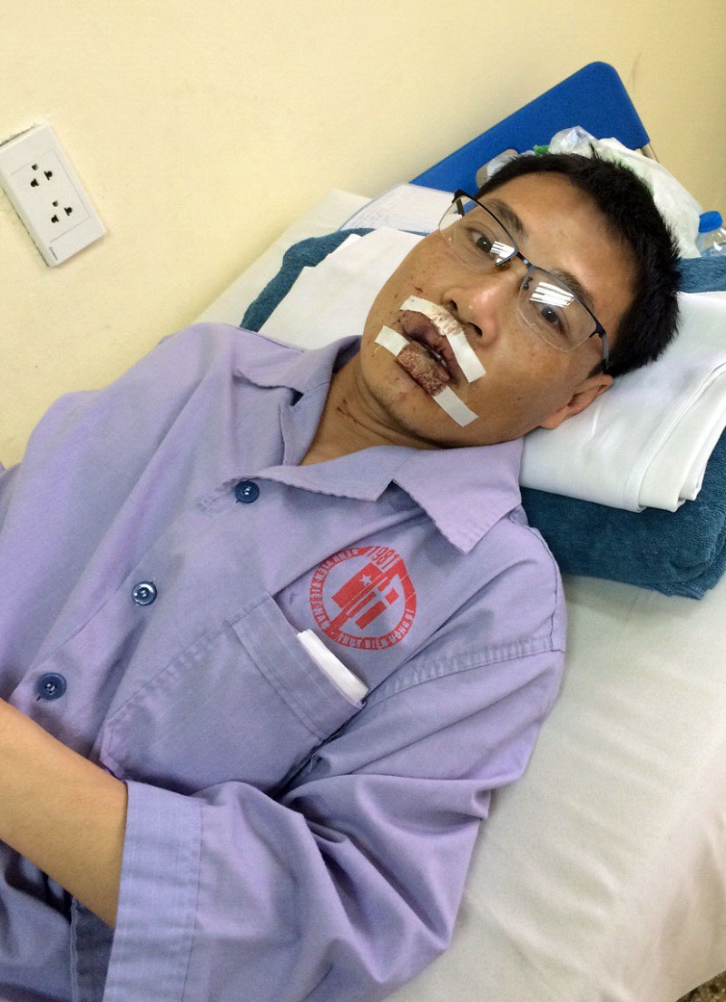 Anh Quang đang nằm điều trị tại BV Việt Nam-Thụy Điển Uông Bí.