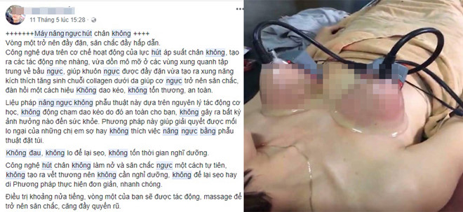 Lời giới thiệu và hình ảnh về phương pháp nâng ngực mới được quảng cáo trên mạng xã hội. Ảnh chụp màn hình