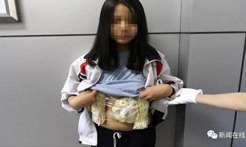 Bé gái người Việt bị phát hiện giấu các món đồ trang sức làm từ ngà voi quanh bụng. Ảnh: Sina.