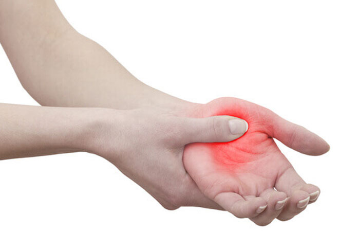 Khi bạn bị tê và ngứa ran ở bàn tay, cổ tay vào ban đêm, đó có thể là triệu chứng của hội chứng ống cổ tay (CTS).  Phụ nữ có nguy cơ mắc hội chứng này cao hơn nam giới, phần lớn ở độ tuổi trung niên. Tình trạng này kéo dài ảnh hưởng xấu đến sức khỏe.