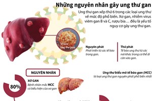 Tìm hiểu những nguyên nhân gây ung thư gan