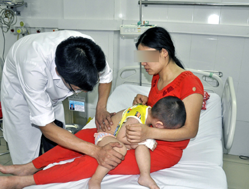 Bác sĩ kiểm tra ban sởi ở trẻ tại Khoa Các bệnh nhiệt đới, Bệnh viện Đa khoa tỉnh. Ảnh: Thu Nguyệt.