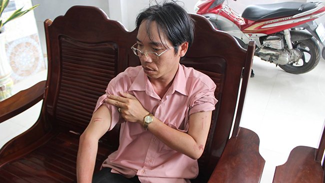 Anh Nguyễn Gia Truyền bị thương do cướp tấn công
