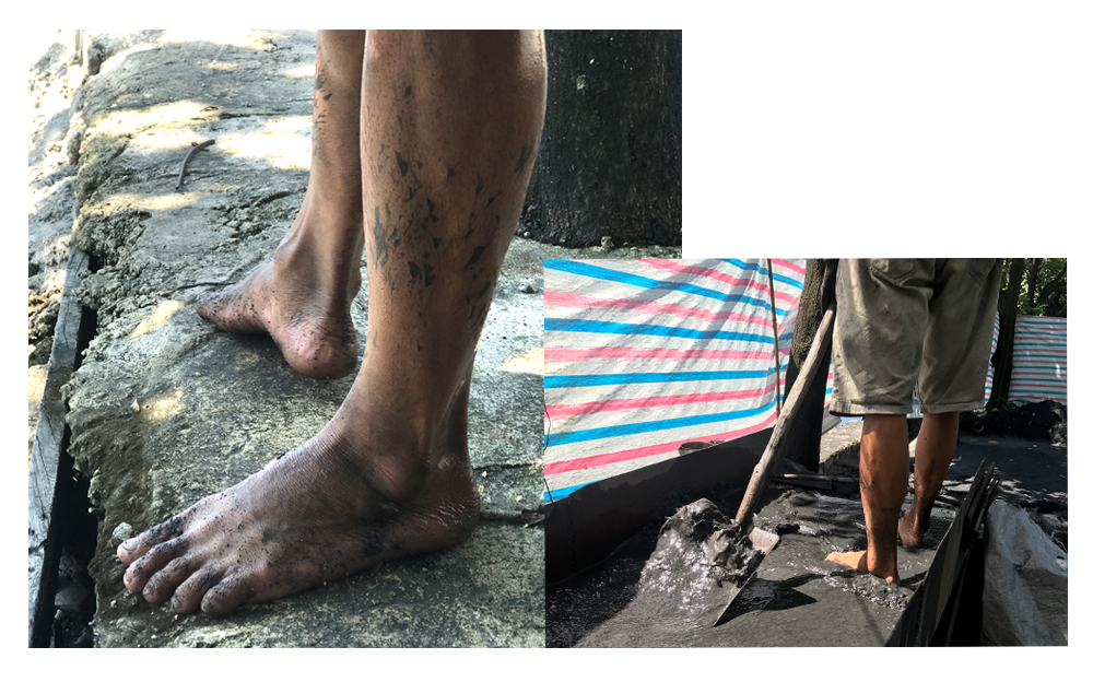 Chân của những người đã vàng lem luốc, thường xuyên bị nấm, nước ăn chân.
