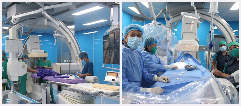  hệ thống máy chụp mạch xóa nền kỹ thuật số 2 bình diện (DSA).
