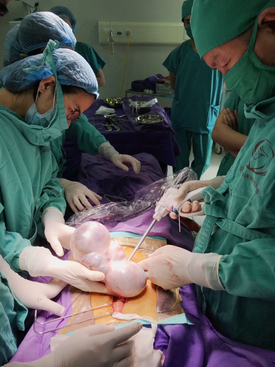 Phẫu thuật cắt khối u cho bệnh nhân bị ung thư buồng trứng 