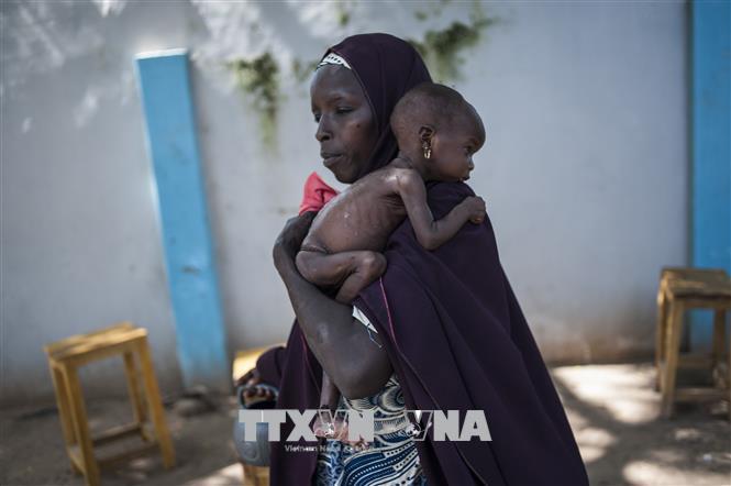 Trẻ em bị suy dinh dưỡng tại Maiduguri, Nigeria. AFP/TTXVN