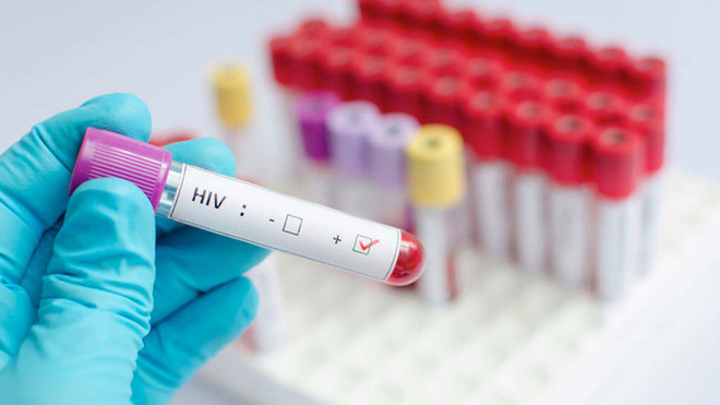 Xét nghiệm HIV thường xuyên có thể chấm dứt hoàn toàn sự lây truyền virus trong tương lai