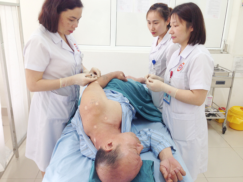 Kỹ thuật châm cứu cấy chỉ được thực hiện tại Bệnh viện ĐKKV Cẩm Phả.
