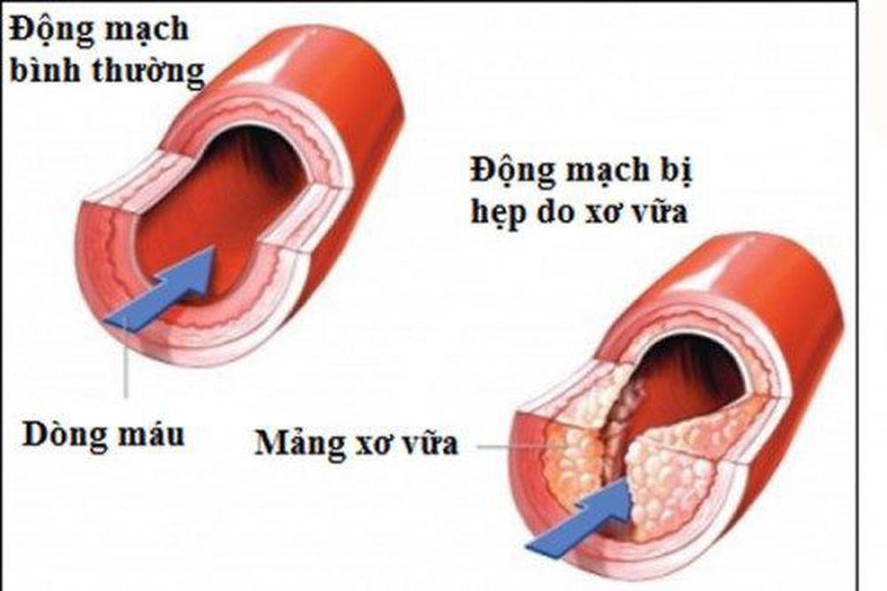 Hình minh họa.
