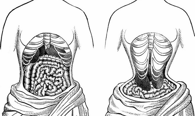 Hình ảnh cơ quan trong cơ thể biến đổi do dùng nịt bụng. Ảnh: Pulse