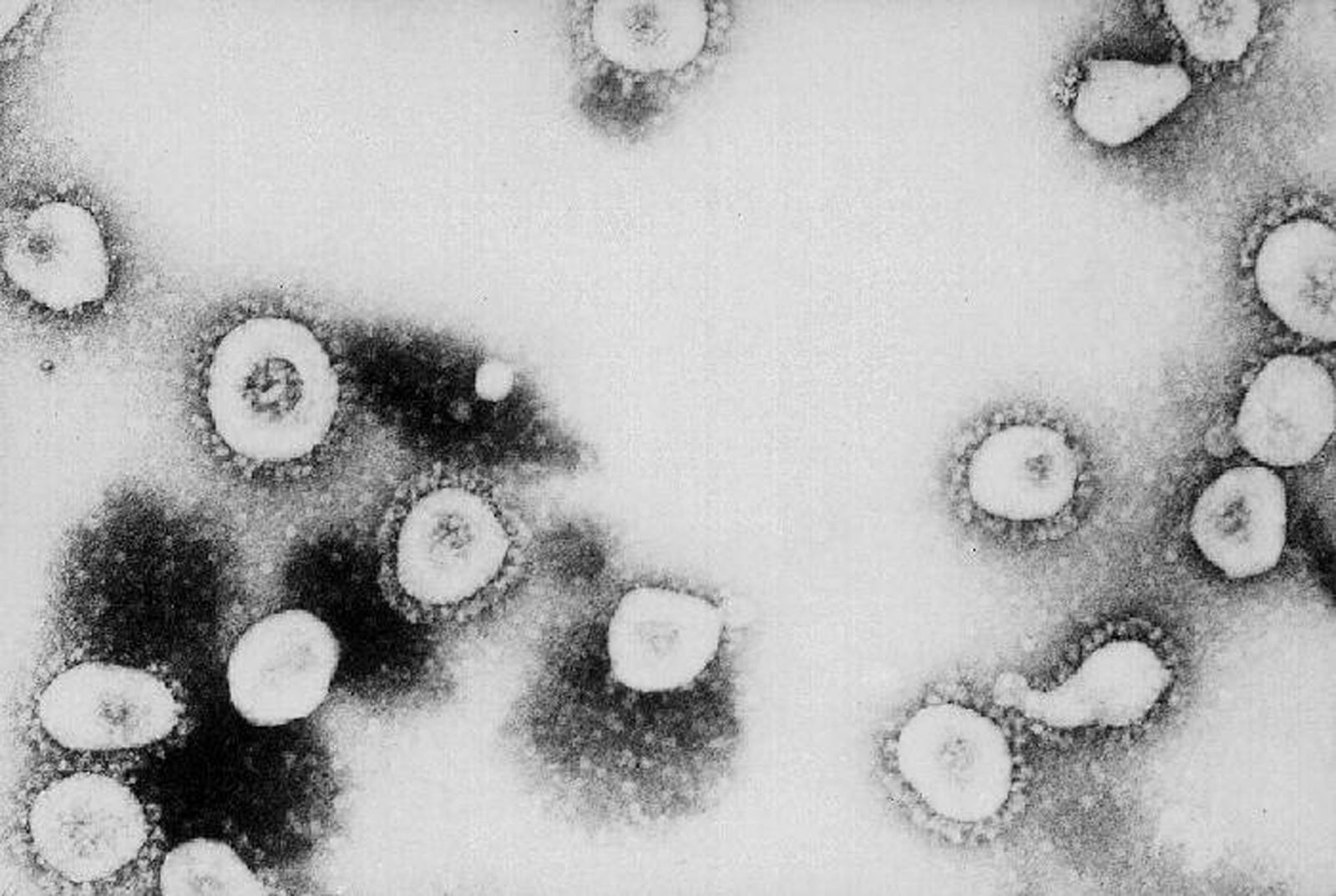 Hình ảnh virus gây SARS dưới kính hiển vi. Ảnh: Getty Images