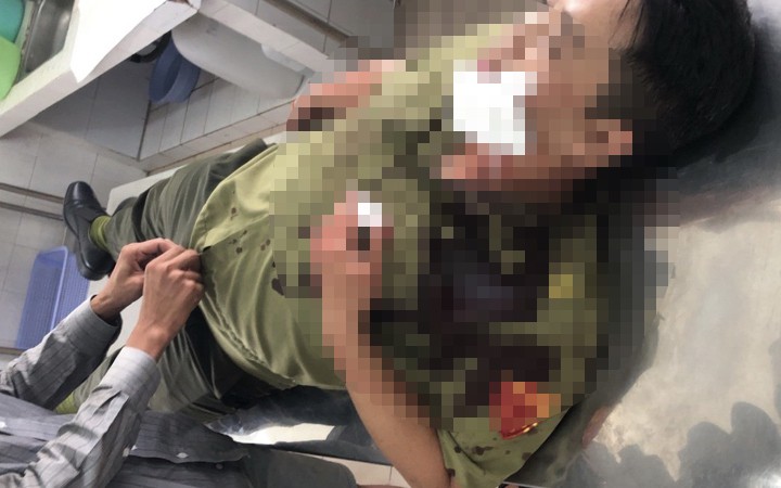  Anh Trần Nguyễn Hữu Huy (24 tuổi) bị tấn công, phải nhập viện cấp cứu