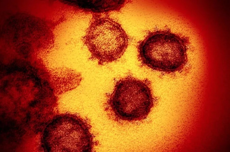 Virus corona xuất hiện trên bề mặt tế bào được ghi lại bằng kính hiển vi điện tử. (Ảnh: South China Morning Post)