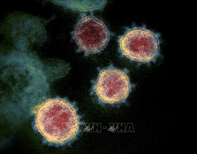 Hình ảnh virus SARS-CoV-2 được soi dưới kính hiển vi. Ảnh: AFP/TTXVN