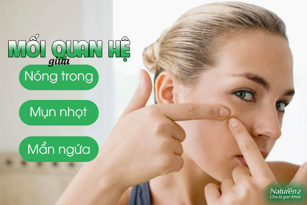 Tình trạng nổi mụn nhọt, mẩn ngứa kéo dài kèm theo các biểu hiện như vàng da, táo bón thì khả năng cao bạn đã bị nóng trong người (ảnh minh hoạ)