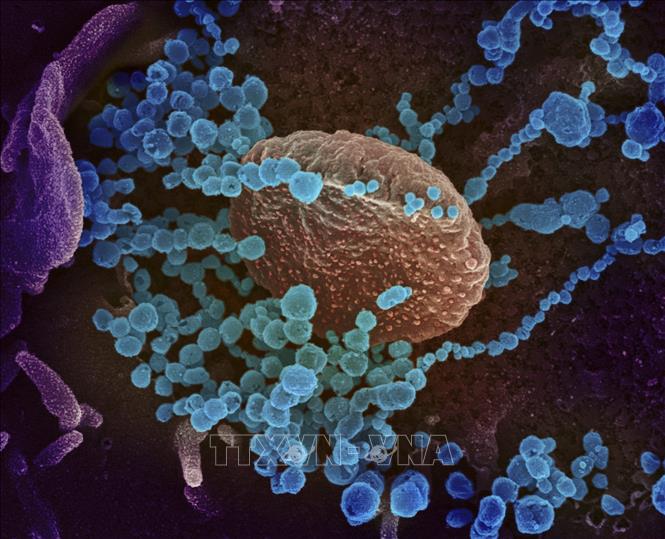 Hình ảnh được quét qua kính hiển vi điện tử tại phòng thí nghiệm của Viện nghiên cứu y tế quốc gia Mỹ cho thấy virus SARS-CoV-2 (vật thể tròn màu xanh) nổi lên trên bề mặt tế bào bệnh nhân nhiễm COVID-19. Ảnh: AFP/TTXVN