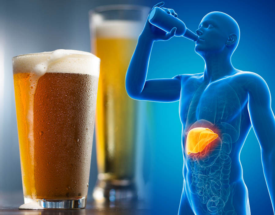 Đồ uống có cồn gây ra 3 vấn đề về gan đó là: gan nhiễm mỡ, viêm gan, suy gan và xơ gan. (ảnh minh hoạ)