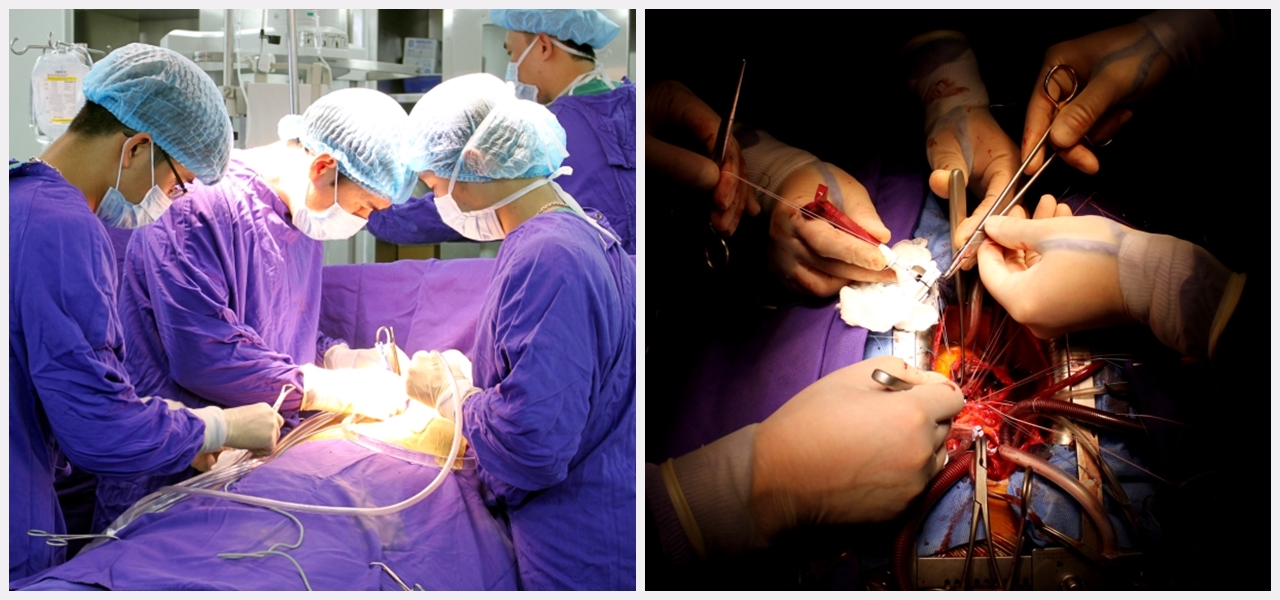 Phẫu thuật tim hở là một trong những kỹ thuật khó của ngành y tế đã được triển khai thành công tại Bệnh viện Đa khoa tỉnh 
