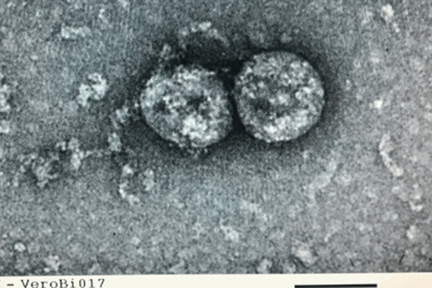 Virus SARS-CoV-2 do Việt Nam nuôi cấy và phân lập trong phòng thí nghiệm. Ảnh: Viện Vệ sinh dịch tễ Trung ương