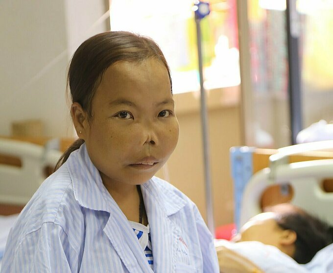 20.000 người Việt sống cả đời với bệnh tan máu - Báo Quảng Ninh ...