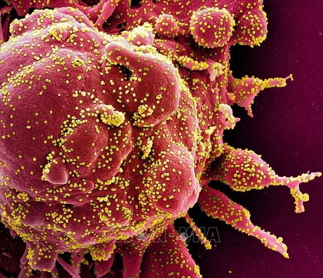 Hình ảnh quét qua kính hiển vi điện tử cho thấy một tế bào (màu đỏ) bị virus SARS-COV-2 (màu vàng) xâm nhập, lấy từ mẫu bệnh phẩm của bệnh nhân COVID-19. Ảnh: AFP/TTXVN