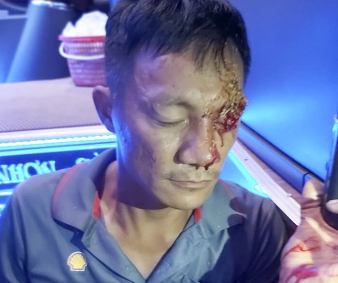 Anh Hiền Phúc, nhân viên hãng xe Mạnh Mùi, bị bắn trọng thương. Ảnh: H.N.