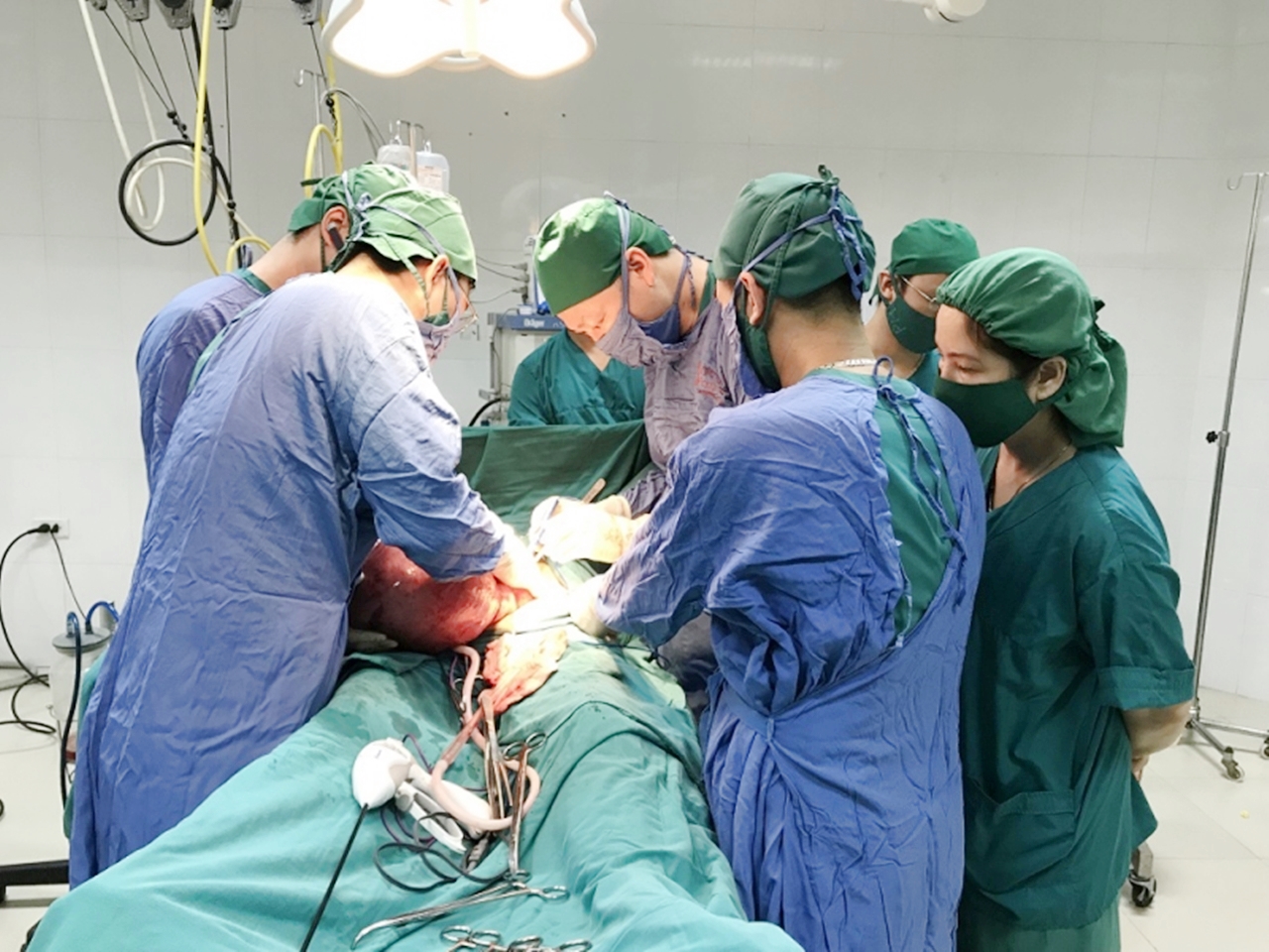 Các bác sĩ Trung tâm Ung bướu, Bệnh viện Bãi Cháy, thực hiện ca phẫu thuật cắt u xơ tử cung.