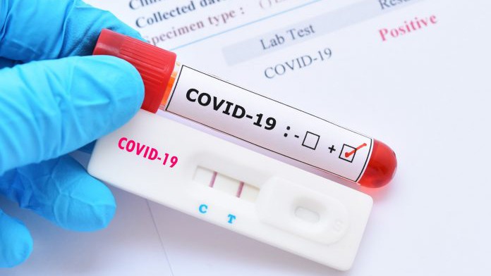 Các nước Đông Âu lập lại mốc kỷ lục số ca nhiễm mới Covid-19. (Ảnh: universul.net)