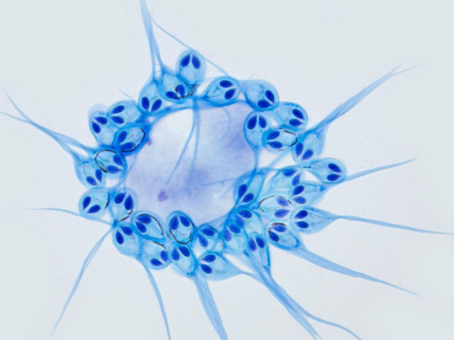 Hình ảnh các đơn bào của ký sinh trùng H. Salminicola dưới kính hiển vi. 'Đôi mắt' giống người ngoài hành tinh thực chất là ngòi đốt. Ảnh: livescience.com