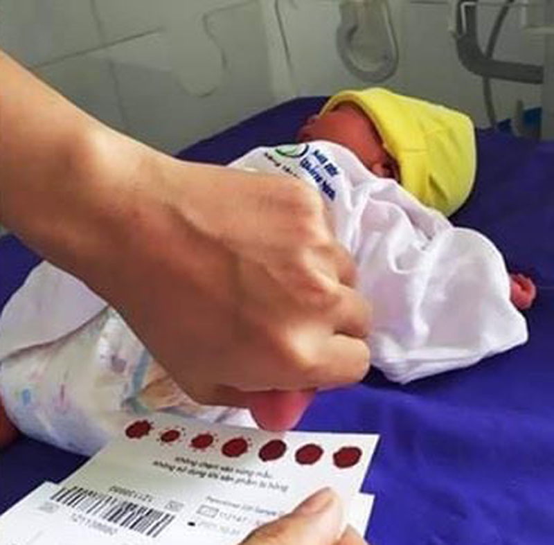 Lấy mẫu máu gót chân ở trẻ sơ sinh tại Bệnh viện Sản nhi tỉnh để sàng lọc một số bệnh bẩm sinh ở trẻ.