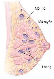 Hình ảnh u nang tuyến vú 