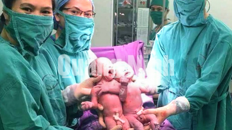 2 bé trai sinh đôi đầu tiên ra đời nhờ thụ tinh ống nghiệm IVF tại Bệnh viện Sản Nhi Quảng Ninh (24-2-2018). Ảnh do Bệnh viện cung cấp