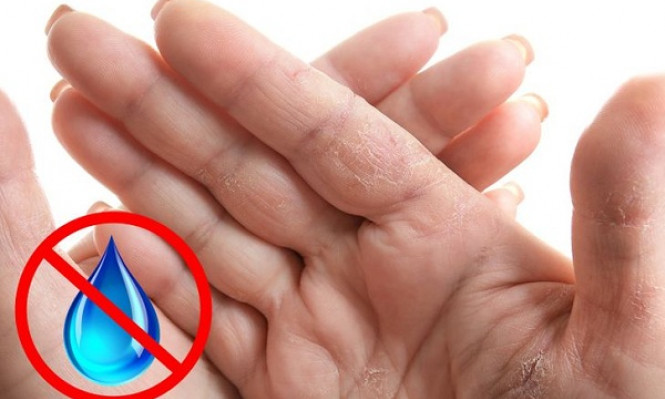 7 dấu hiệu trên bàn tay cảnh báo bất ổn về sức khỏe