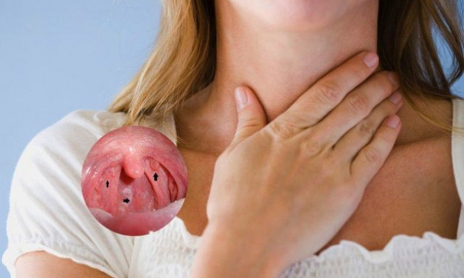 4 dấu hiệu sớm của ung thư vòm họng