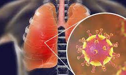 SARS-CoV-2 tấn công phổi như thế nào?