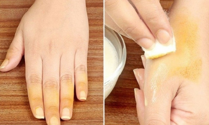 Mẹo tẩy vết nghệ trên da, quần áo và bát đĩa