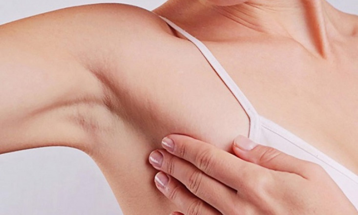 Loại ung thư dễ phát hiện nhất, vẫn có 50% bệnh nhân đến viện khi đã muộn
