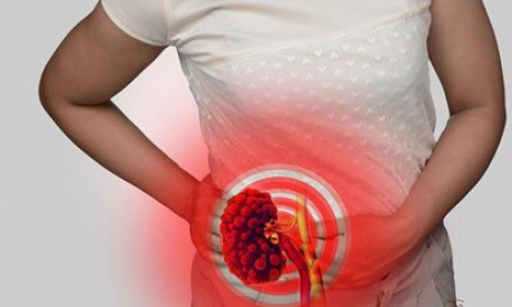 7 nguyên tắc để người bệnh thận mạn sống an lành trong dịch COVID-19