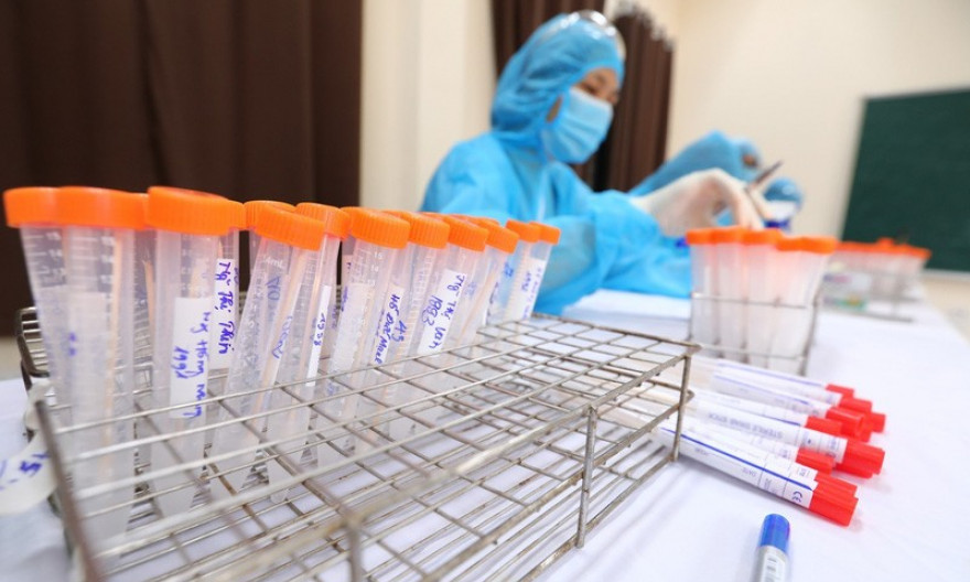 Trưa 2/7: Thêm 175 ca mắc COVID-19, riêng TP. Hồ Chí Minh 151 ca